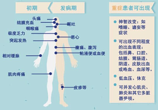 埃博拉初期病癥